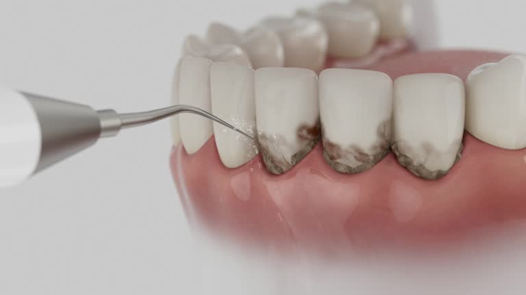 Reliable Dental Implants contractor in Palmdale, CA by Smile Center Dentistry